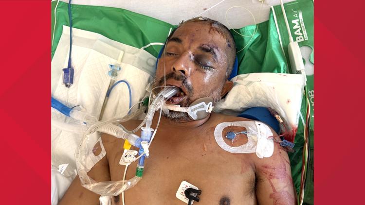 University Hospital asks for help identifying unconscious patient hit by truck Saturday evening — KENS 5 (San Antonio), Walnut Creek Health news